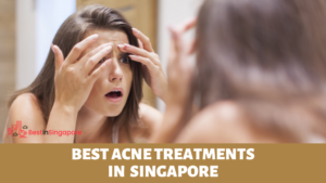 Best Acne Treatments Singapore