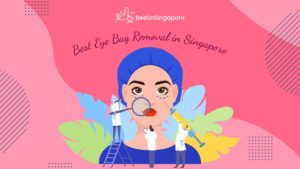 Best Eye Bag Removal in Singapore