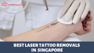 Best Laser Tattoo Removals Singapore