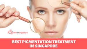 Best Pigmentation Treatment in Singapore