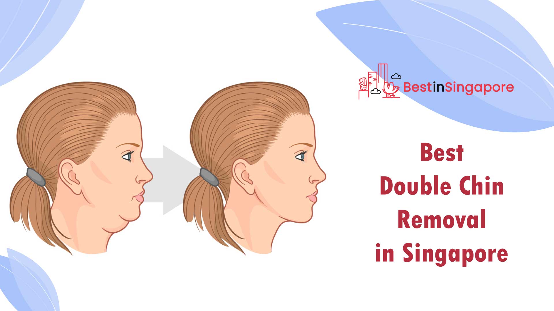 Best Double Chin Removal in Singapore