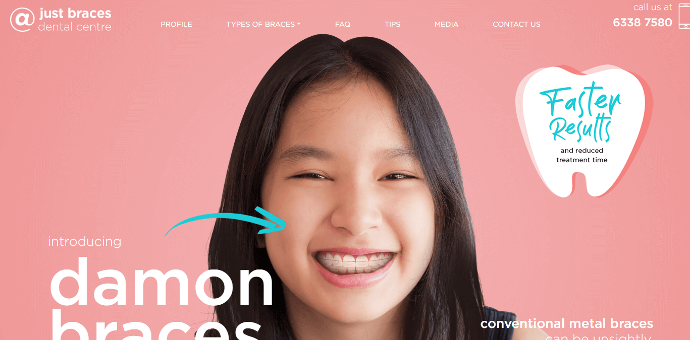 Just Braces' Homepage