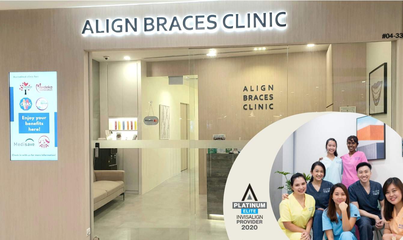 Align Braces' Clinic