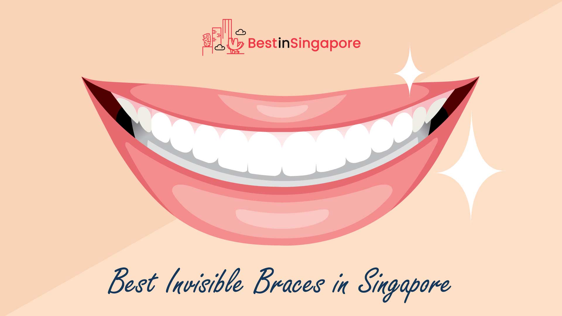 Best Invisible Braces in Singapore