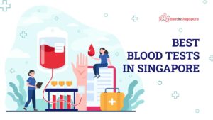 Best Blood Tests in Singapore