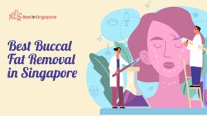 Best Buccal Fat Removal in Singapore