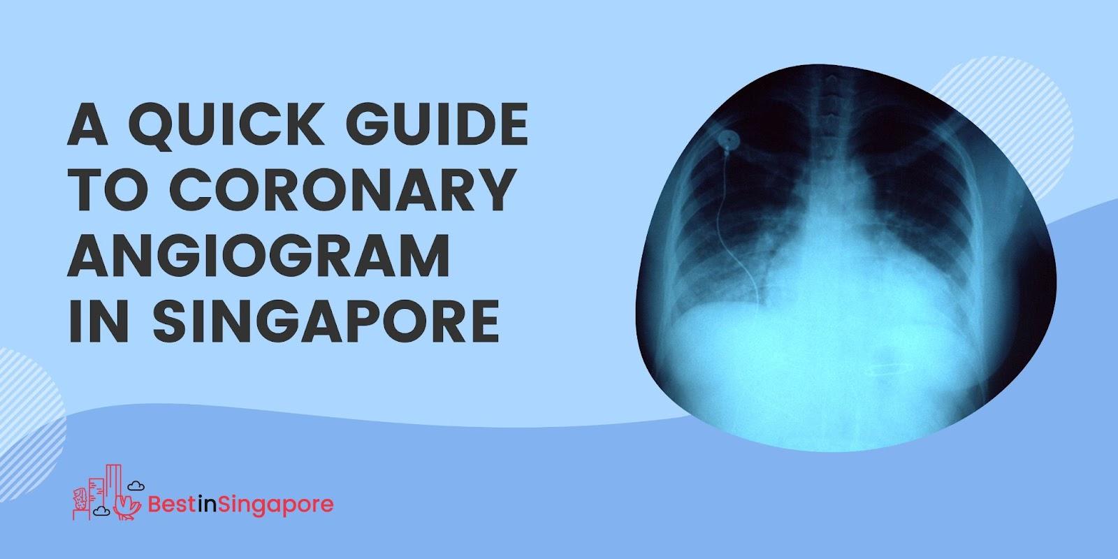A Quick Guide to Coronary Angiogram in Singapore