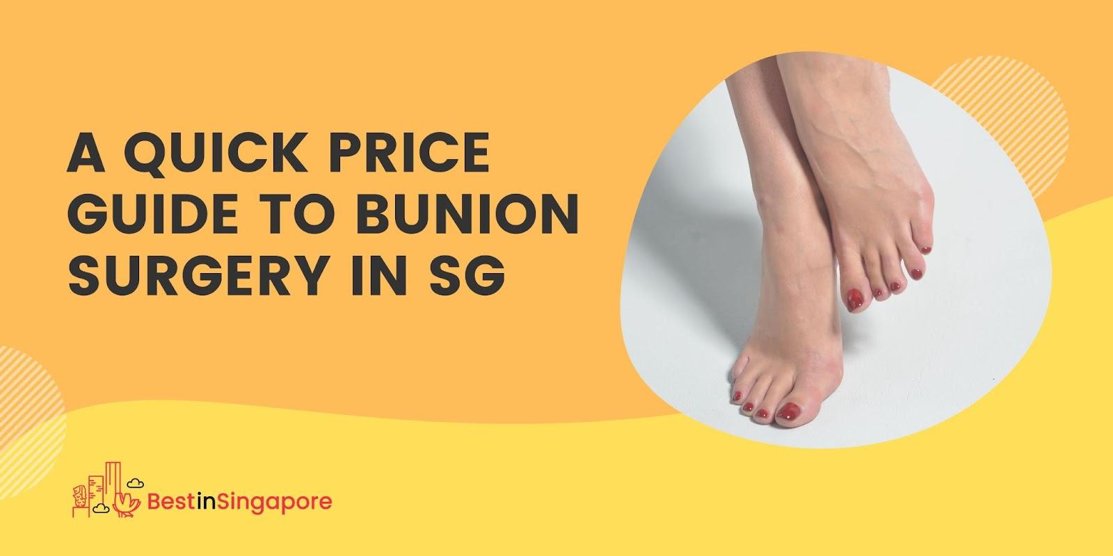 A Quick Price Guide to Bunion Surgery in SG