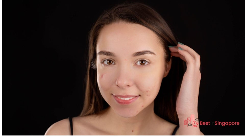 Does your skin get easily irritated