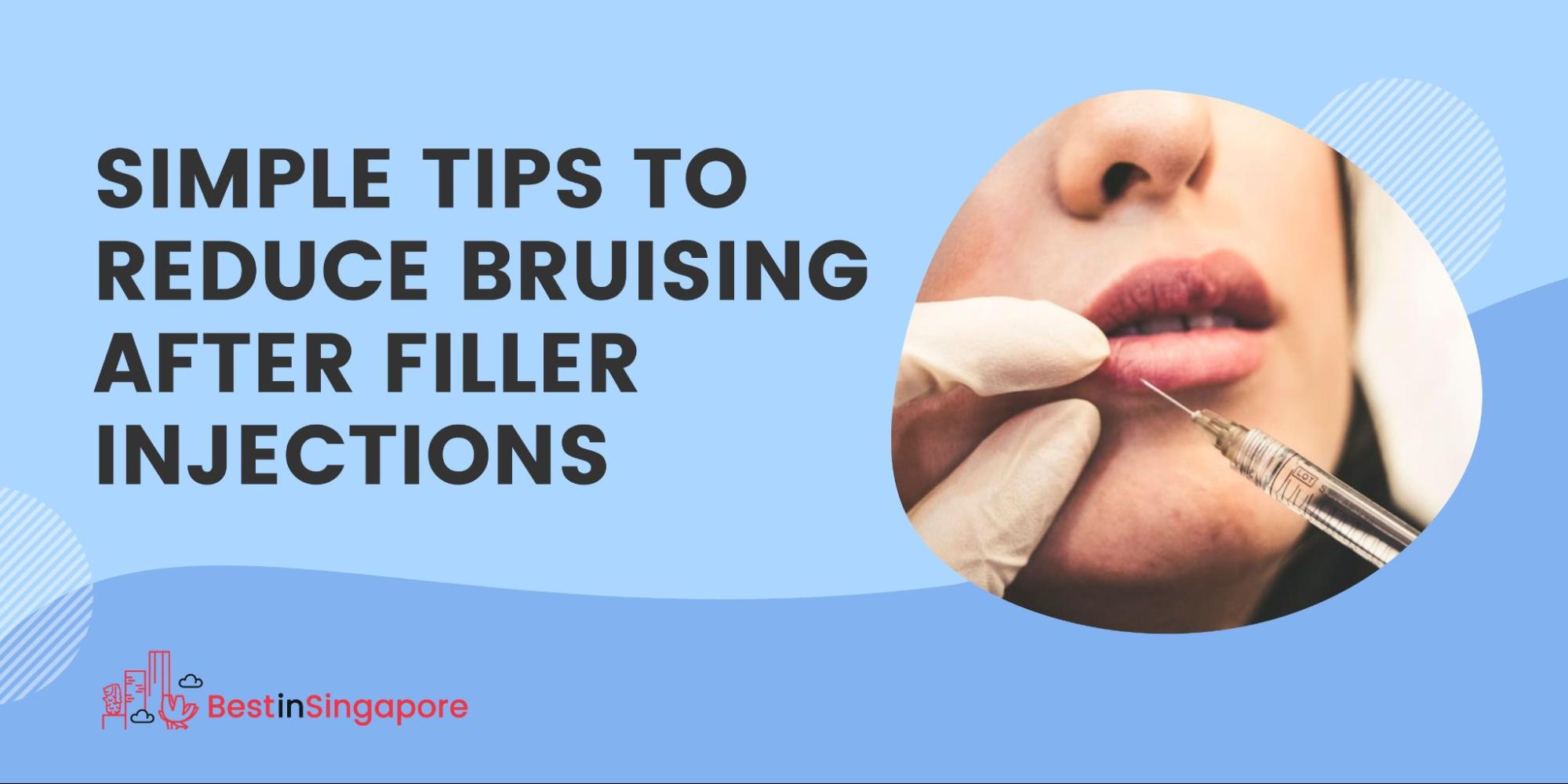 Simple Tips to Reduce Bruising After Filler Injections