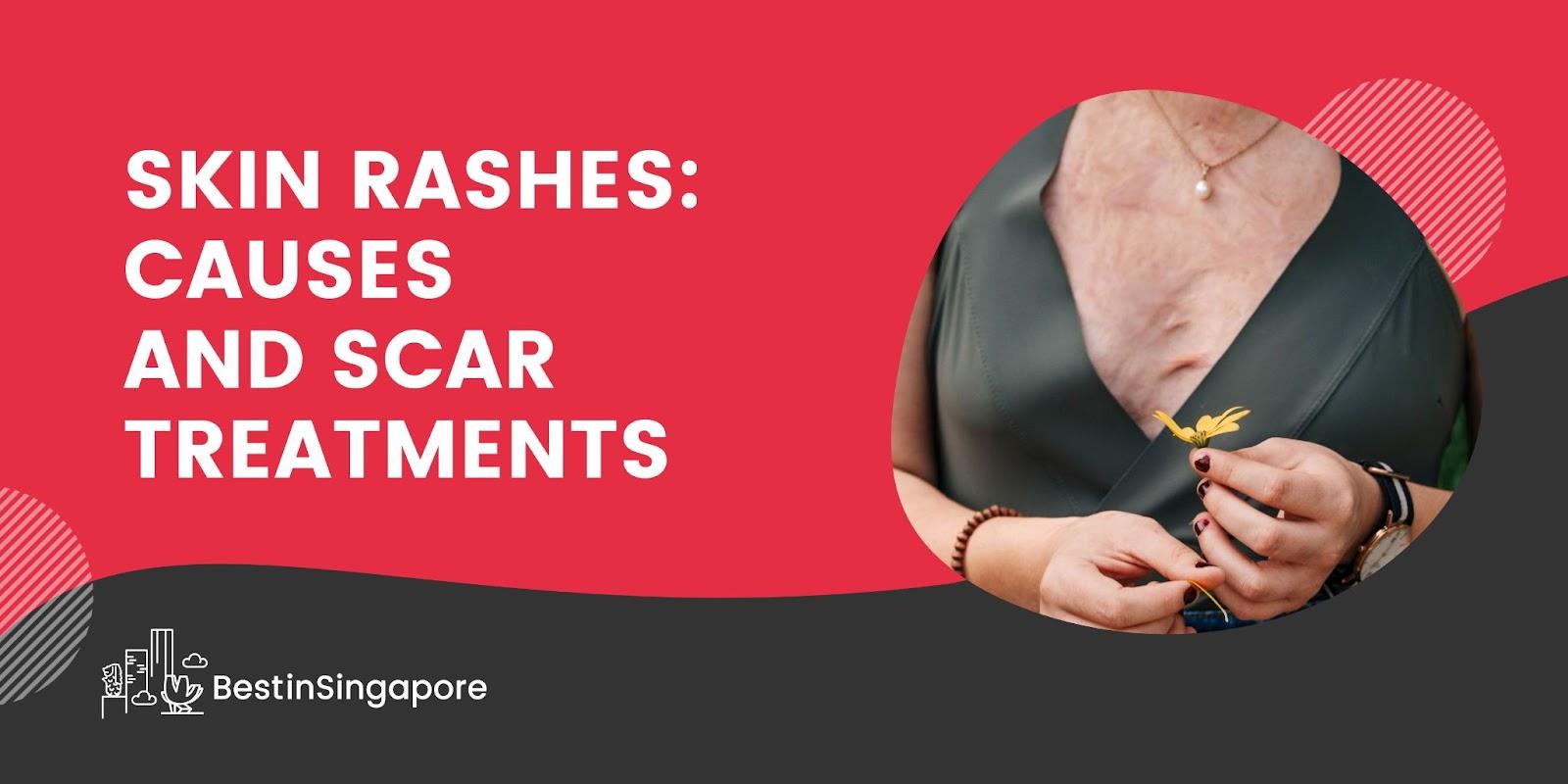 Skin Rashes Causes and Scar Treatments