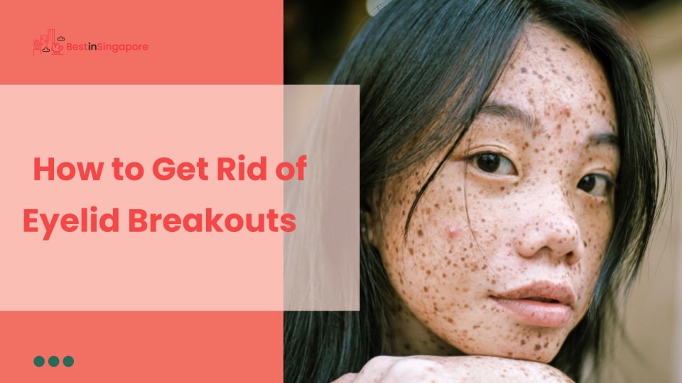 How to Get Rid of Eyelid Breakouts