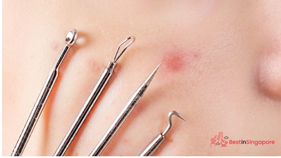Picking and Popping Pimples