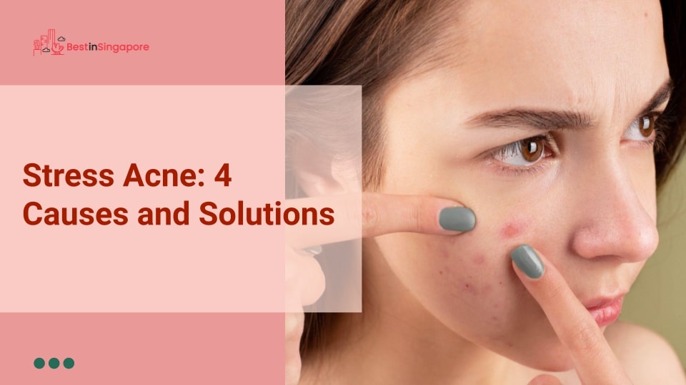 Stress Acne 4 Causes and Solutions