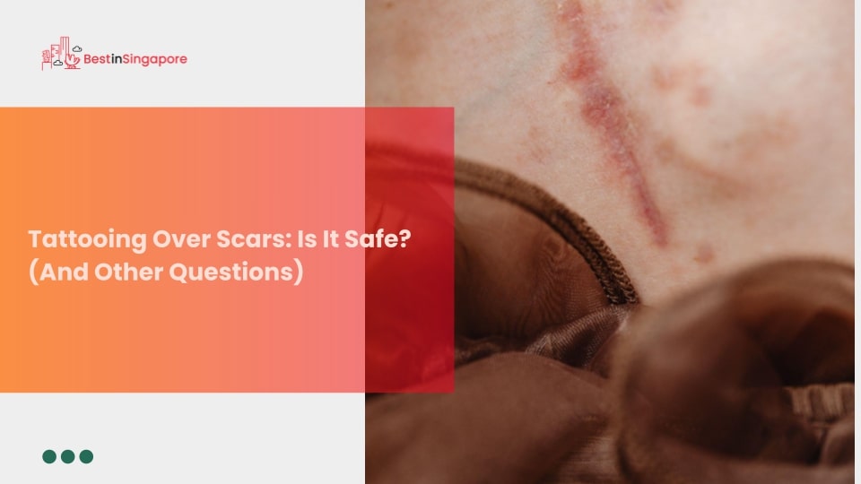 Tattooing over Scars Is It Safe (And Other Questions)