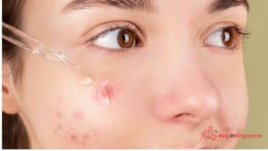 Use retinol as a spot treatment