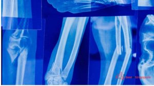 When You Need Professional Medical and Investigative Evaluation for Your Claim