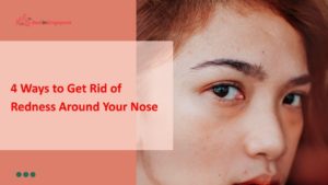 4 Ways to Get Rid of Redness around Your Nose