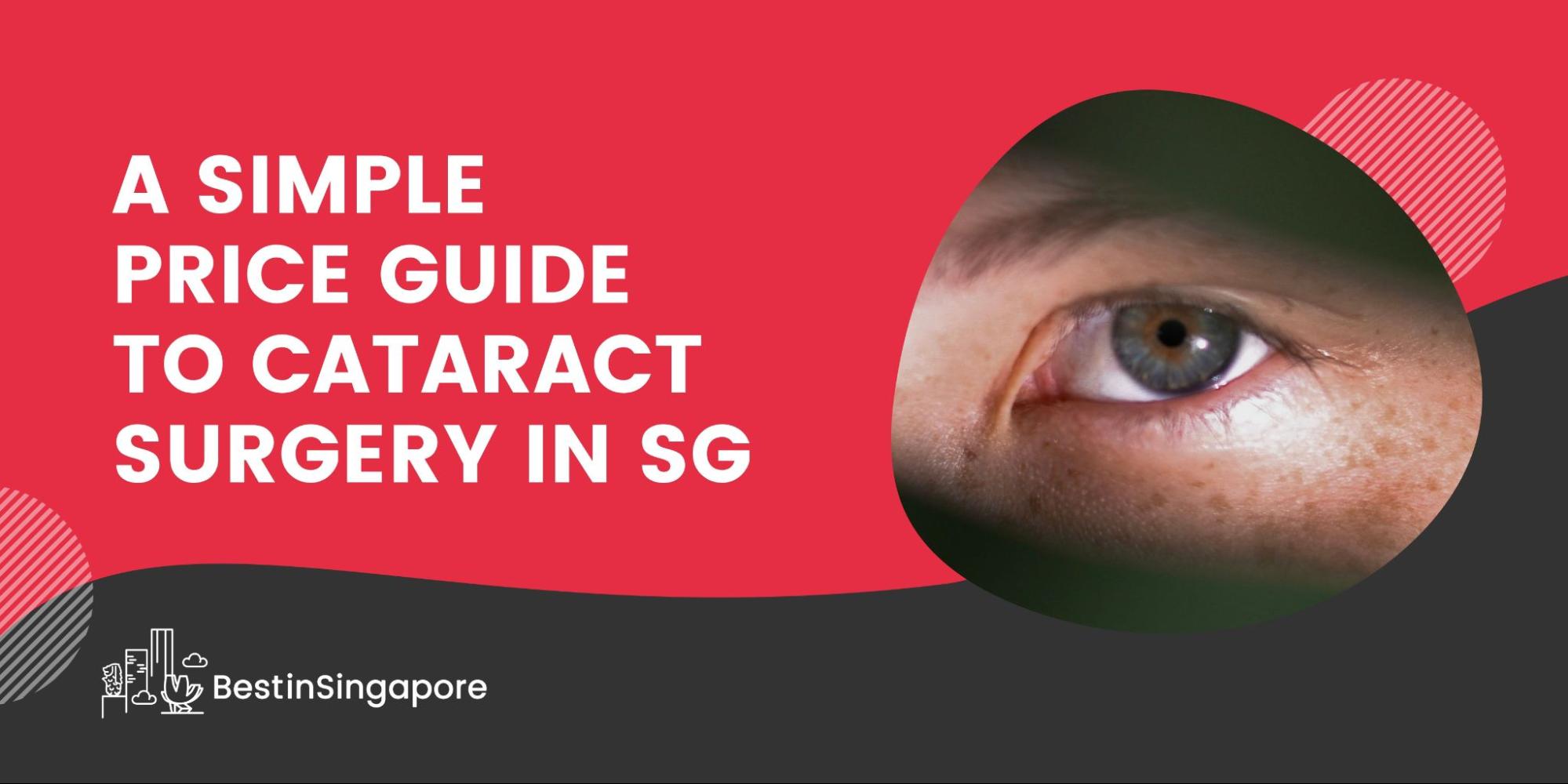 A Quick Price Guide to Cataract Surgery in SG
