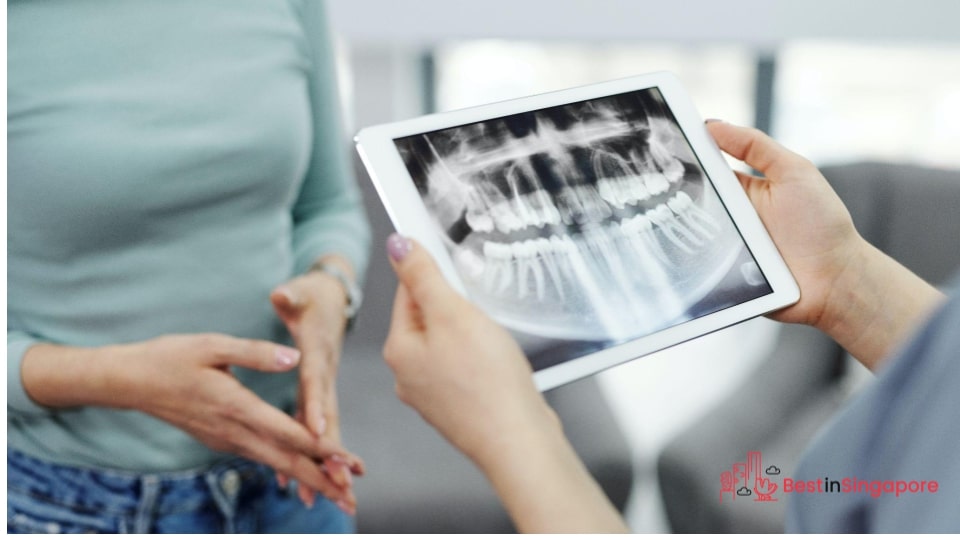 Dental X-rays for Children and Adults