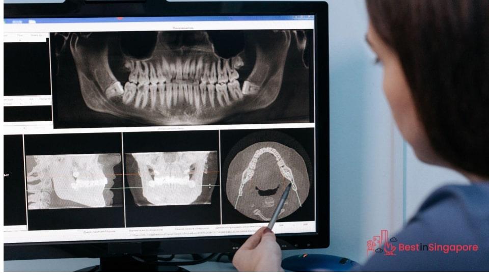Different Types of Dental X-rays