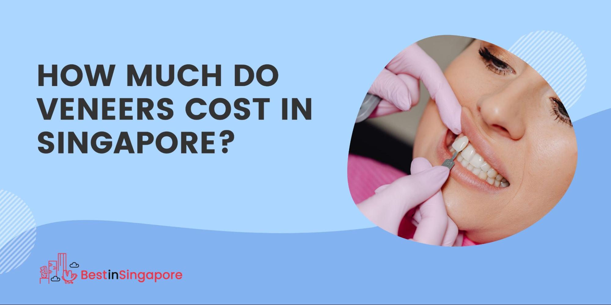 How much do veneers cost in Singapore