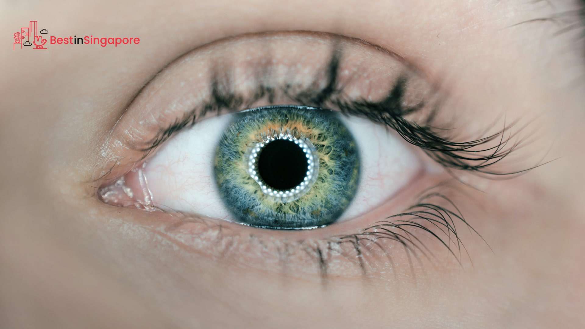 The Road to 2020 Vision LASIK vs. ReLEx SMILE in Singapore